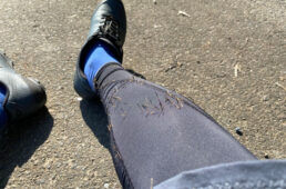 ひっつき虫がついた脚